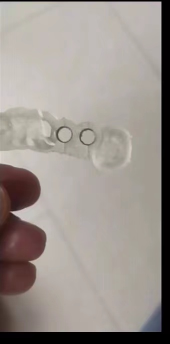 Resin Dental 3D Printer Planti - 3D Printing Dental ulasan dan harga